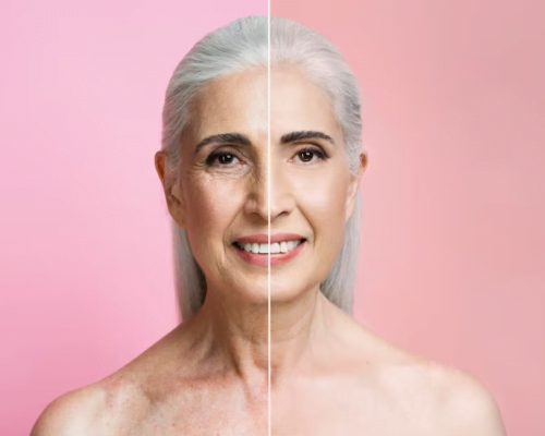 Anti-aging Treatment