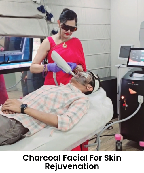 Charcoal Facial For Skin Rejuvenation