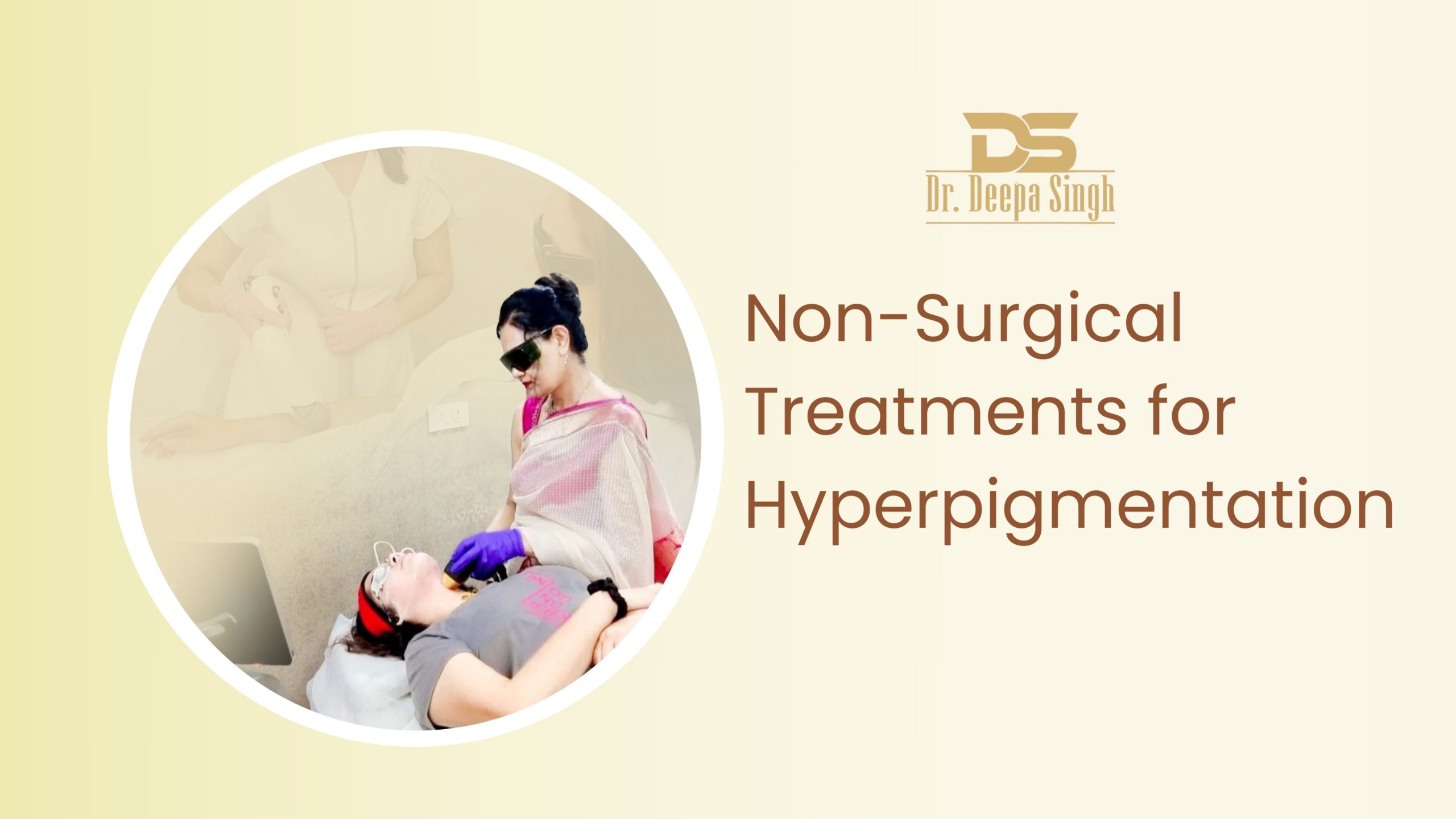 Non-Surgical Treatments For Hyperpigmentation