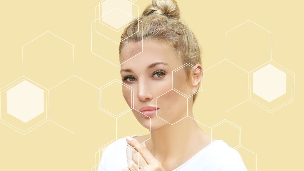 Non-Surgical Treatments For Hyperpigmentation