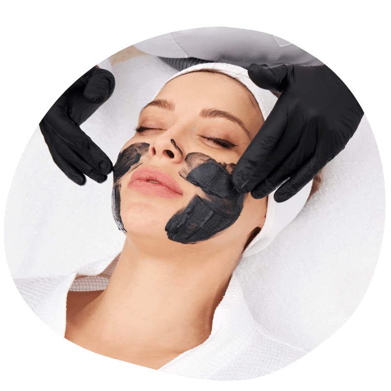 Carbon laser facial treatment in Udaipur, Carbon laser facial specialist in Udaipur