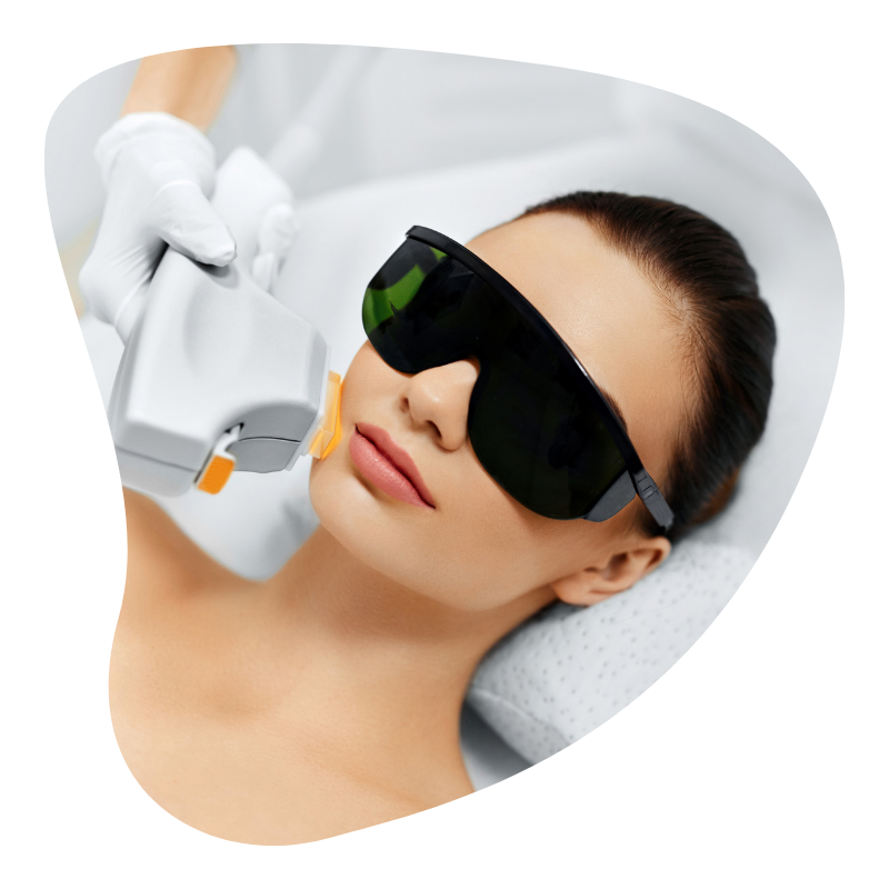 Photofacial Treatment in Udaipur, Photofacial in Udaipur