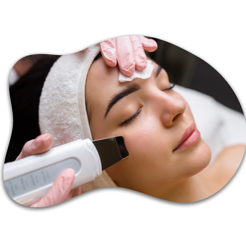 Photofacial Treatment in Udaipur, Photofacial in Udaipur