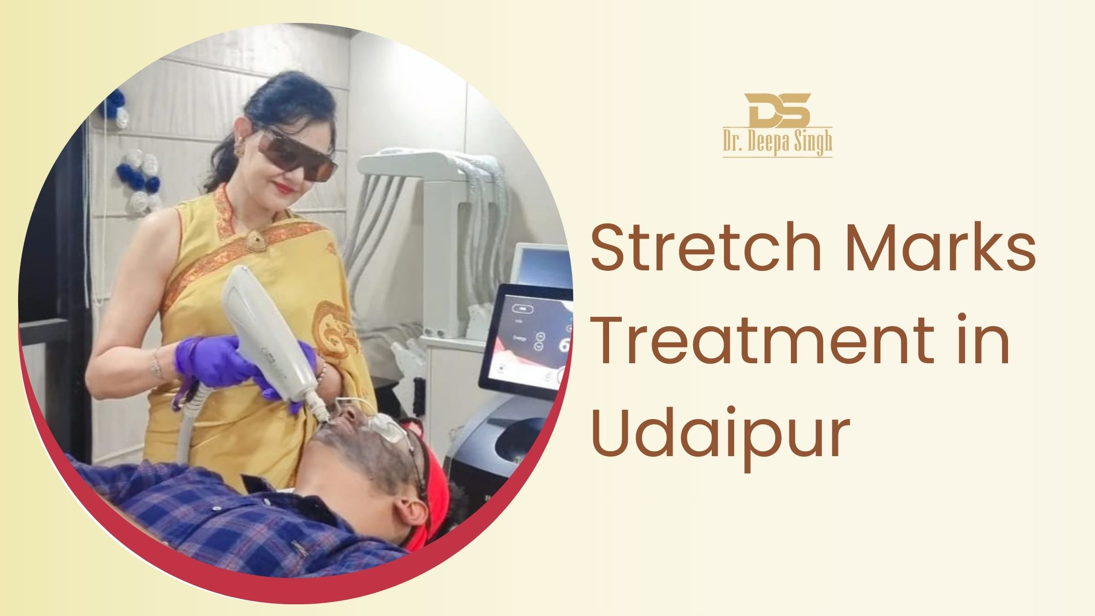Stretch Marks Treatment in Udaipur by Dr. Deepa Singh using advanced laser technology at ARTH Skin & Fitness