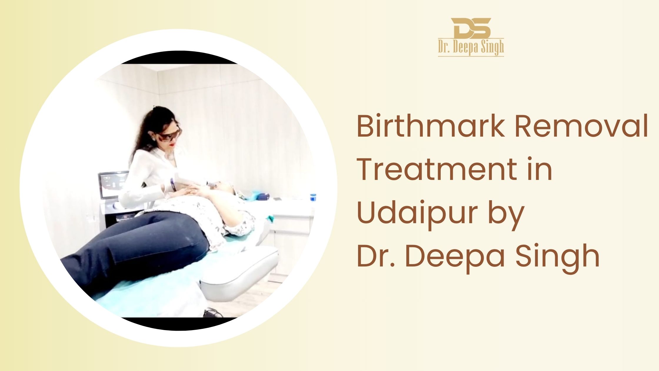 Advanced birthmark removal treatment in Udaipur using laser technology by Dr Deepa Singh for clear and even skin