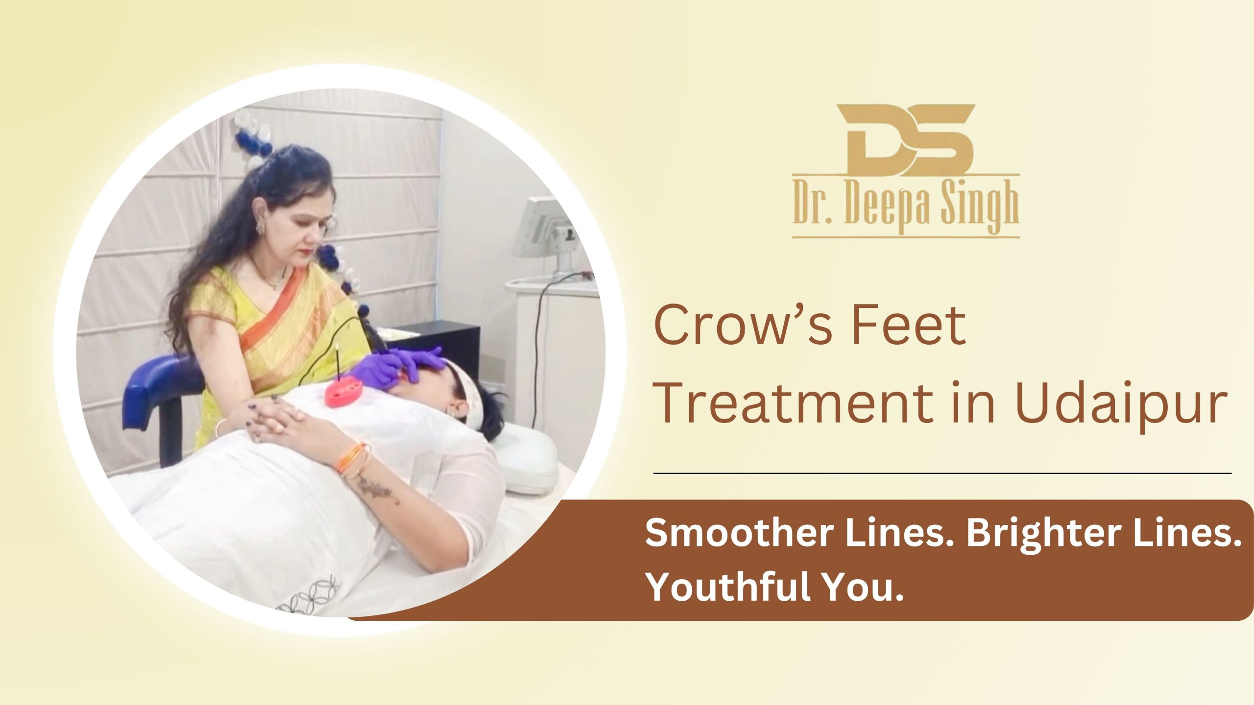 Crow’s Feet Treatment in Udaipur by Dr. Deepa Singh for youthful and refreshed eyes